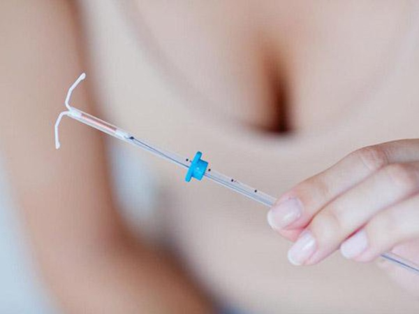 Đặt vòng tránh thai là một thủ thuật y tế đơn giản